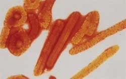ebola Virus ebola Virus