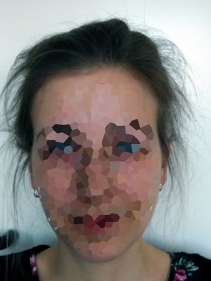 Bild